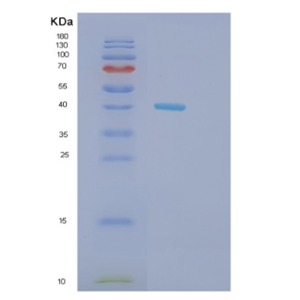 Recombinant Mouse Hdac8 Protein