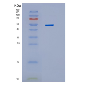 Recombinant Human Hexokinase 4 Human Protein