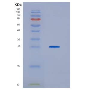 Recombinant HCV-E2 Protein,Recombinant HCV-E2 Protein