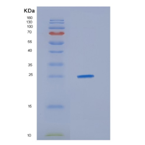 Recombinant Human HDGFRP3 Protein