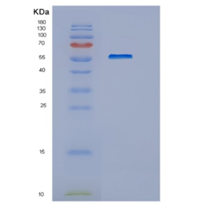 Recombinant Human HEXA Protein