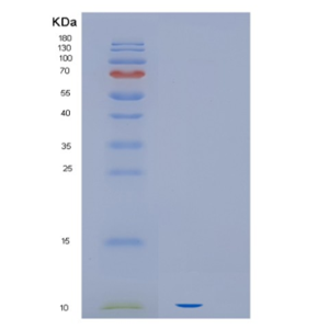 Recombinant Human HIF1a Protein,Recombinant Human HIF1a Protein