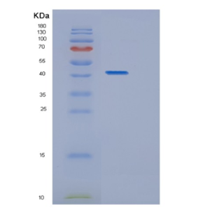 Recombinant Human HDAC8 Protein,Recombinant Human HDAC8 Protein