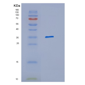 Recombinant Human HFE Protein,Recombinant Human HFE Protein