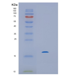 Recombinant Human HINT2 Protein,Recombinant Human HINT2 Protein