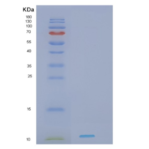 Recombinant Human HDGF Protein,Recombinant Human HDGF Protein