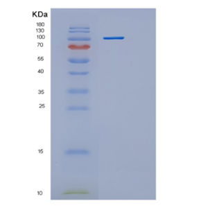 Recombinant Human Hexokinase 2 Human Protein,Recombinant Human Hexokinase 2 Human Protein