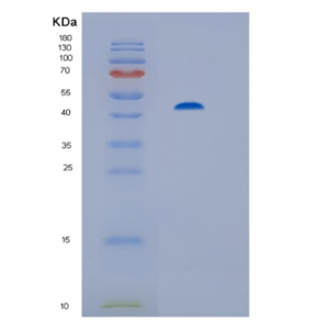 Recombinant Human His-PP2Cα(His-tagging Protein phosphatase 2C) Protein