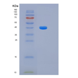 Recombinant Human HIBCH Protein,Recombinant Human HIBCH Protein