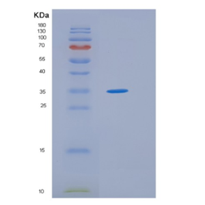 Recombinant Human HLF Protein