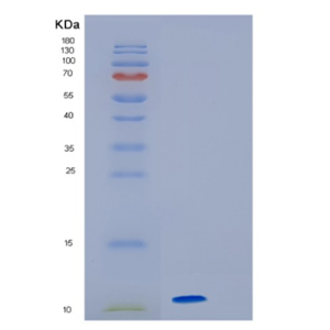 Recombinant Human HMGA2 Protein