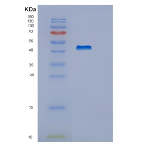 Recombinant Human HEXIM1 Protein