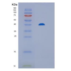 Recombinant Human Hip/ST13 Protein,Recombinant Human Hip/ST13 Protein