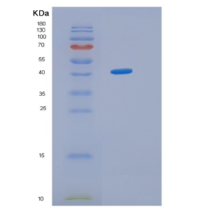 Recombinant Human HMBS Protein,Recombinant Human HMBS Protein