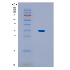 Recombinant Human HLA-C Protein,Recombinant Human HLA-C Protein