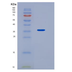 Recombinant Human HNMT Protein,Recombinant Human HNMT Protein