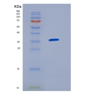 Recombinant Human HNRNPA1 Protein,Recombinant Human HNRNPA1 Protein