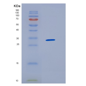 Recombinant Human HNRNPAB Protein,Recombinant Human HNRNPAB Protein