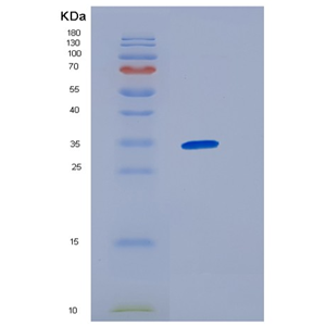 Recombinant Human HNRNPC Protein,Recombinant Human HNRNPC Protein