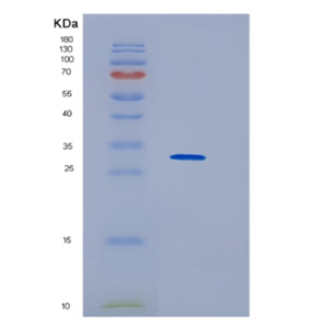 Recombinant Human HNRNPK Protein,Recombinant Human HNRNPK Protein