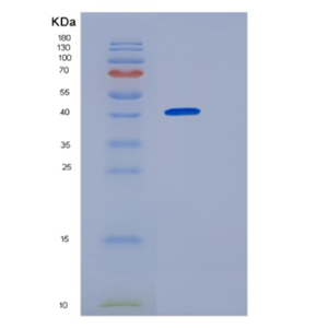 Recombinant Human Homer 1 Protein,Recombinant Human Homer 1 Protein