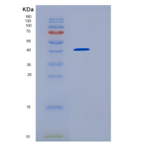 Recombinant Human HOMER2 Protein,Recombinant Human HOMER2 Protein