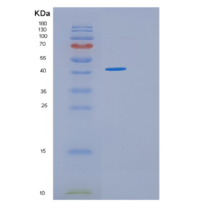 Recombinant Human HOMER3 Protein