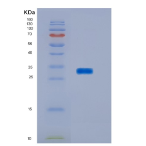 Recombinant Human HOXA9 Protein,Recombinant Human HOXA9 Protein