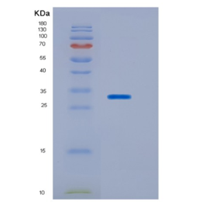 Recombinant Human HOXB13 Protein