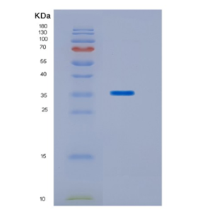 Recombinant Human HOXC11 Protein