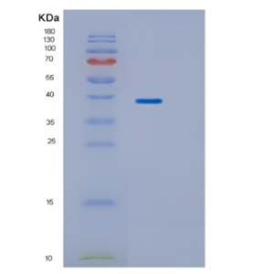 Recombinant Human HP Protein,Recombinant Human HP Protein