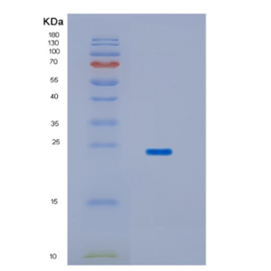 Recombinant Human HPCAL1 Protein,Recombinant Human HPCAL1 Protein