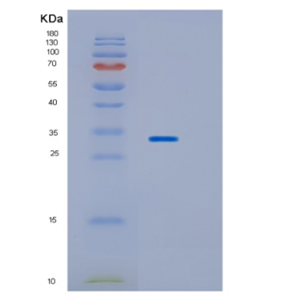 Recombinant Human HPGD Protein,Recombinant Human HPGD Protein