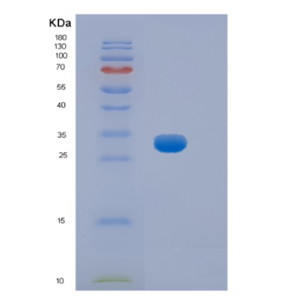 Recombinant Mouse Hpgd Protein