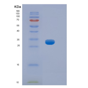 Recombinant Mouse Hpgd Protein,Recombinant Mouse Hpgd Protein