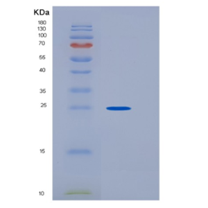 Recombinant Human HPGDS Protein