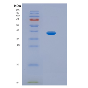 Recombinant Human HPR Protein,Recombinant Human HPR Protein