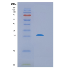 Recombinant Human HPRT1 Protein