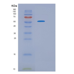 Recombinant Human HRS (Histidyl-tRNA synthetase) Protein