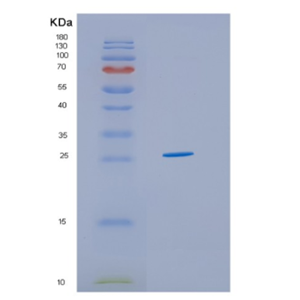 Recombinant Human HSCB Protein