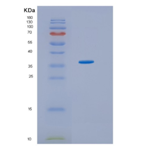 Recombinant Human HSD17B1 Protein