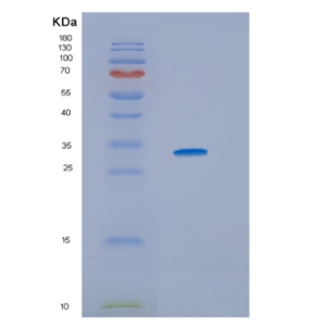 Recombinant Human HSD17B10 Protein