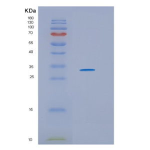 Recombinant Human HSD17B11 Protein