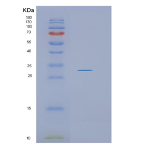 Recombinant Human HSD17B14 Protein