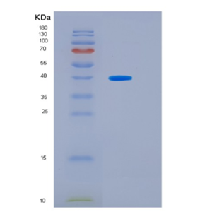 Recombinant Human HSF2BP Protein