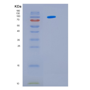 Recombinant E.coli Hsp104(amino acids 1-908) Saccharomyces cerevisiae Protein