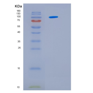 Recombinant Human HSP105α 1-858 aa Protein,Recombinant Human HSP105α 1-858 aa Protein