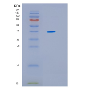 Recombinant Human HSP40(DNAJ) Human Protein
