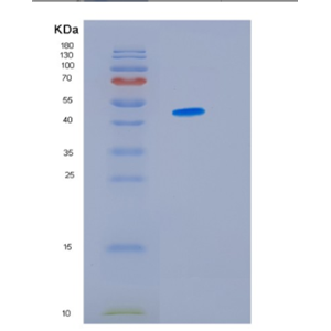 Recombinant Human HSP47(Colligin) Protein,Recombinant Human HSP47(Colligin) Protein