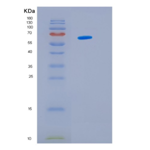Recombinant Human HSP60 Protein,Recombinant Human HSP60 Protein